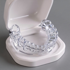 Ortho Align Clear Aligner