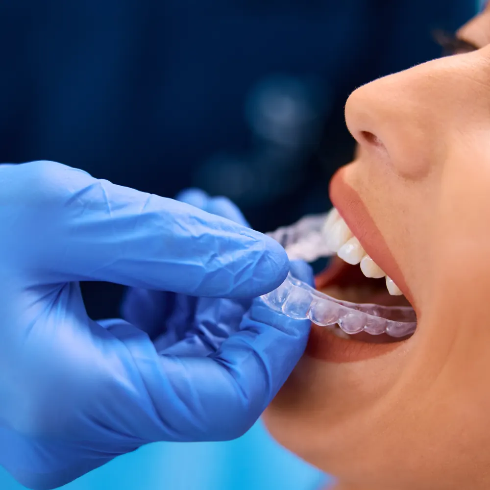 Orthodontist fitting a clear aligner