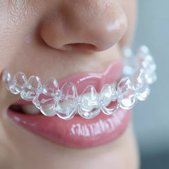 Ortho Align Clear Aligner